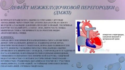 Межжелудочковая перегородка сердца это