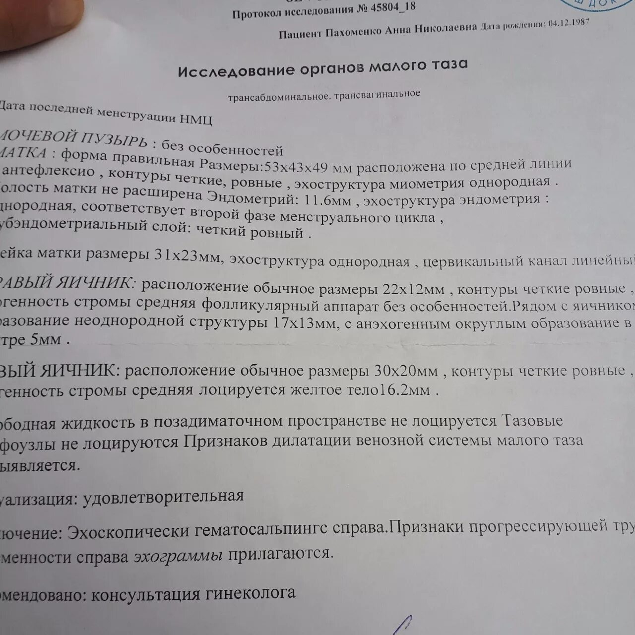 Не лоцируется что это