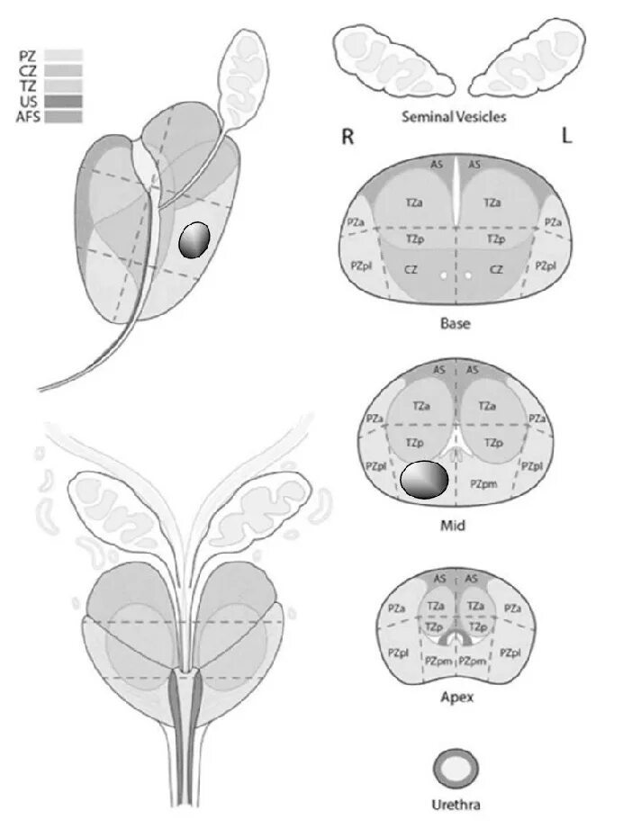 Схема предстательной железы Pirads. Зоны предстательной железы по Pirads. Схема Pi-rads. Предстательная железа Pi rads.