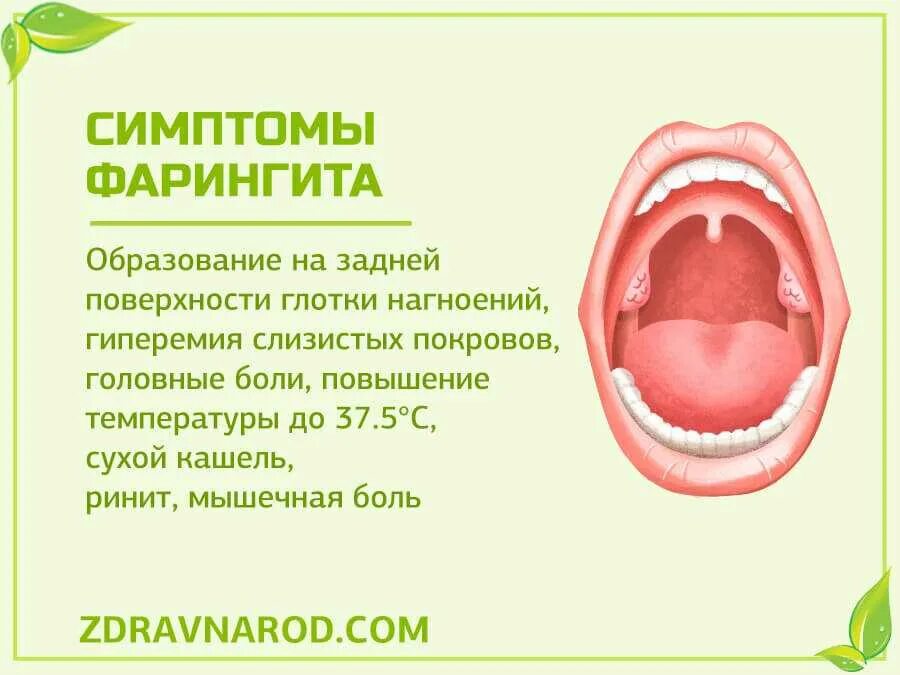 Что такое фарингит симптомы лечение у взрослых. Хронический гранулезный фарингит. гранулезный тонзиллит.