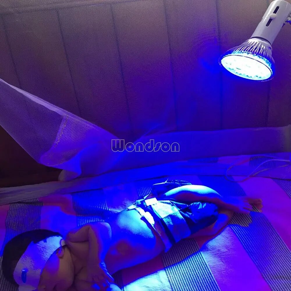 Лампа для фототерапии фл 2/с. Лампа от желтушки from jaundice. Лампа доктор ультрафиолет от желтушки. Синяя лампа для новорожденных от желтушки. Прокат ламп