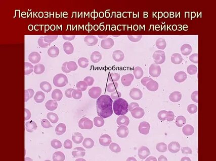 Лимфобласты