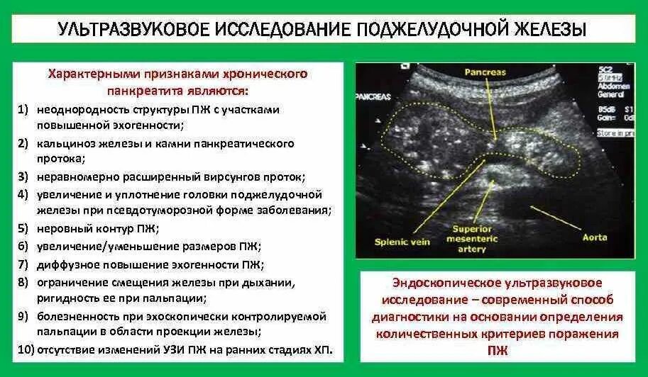 Норма УЗИ поджелудочной железы эхоструктура. УЗИ диагностика поджелудочной железы болезни. Хронический панкреатит УЗИ изменения. Подготовка пациента Киузи поджелудочной железы. После узи болит