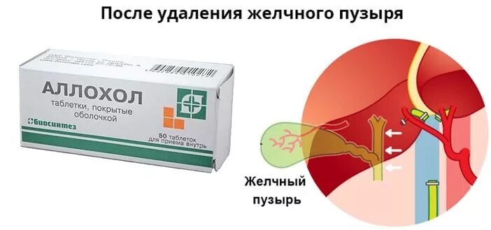 Масло после удаления желчного. Препараты после удаления желчного пузыря. Таблетки при удаленном желчном пузыре. Если удален желчный пузырь. После операции желчного пузыря таблетки.