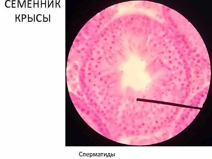 Семенник крысы гистология. Семенник крысы гистология