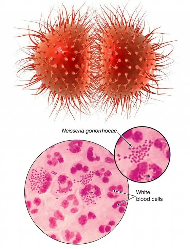 Chlamydia trachomatis neisseria gonorrhoeae. Нейссерия гонорея микробиология.