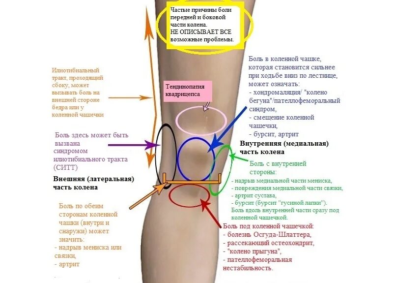 Болит под коленкой. Острая боль под коленной чашечкой спереди. Строение колена болит сбоку. Ноет под коленной чашечкой спереди. Болит колено сбоку с внутренней стороны.