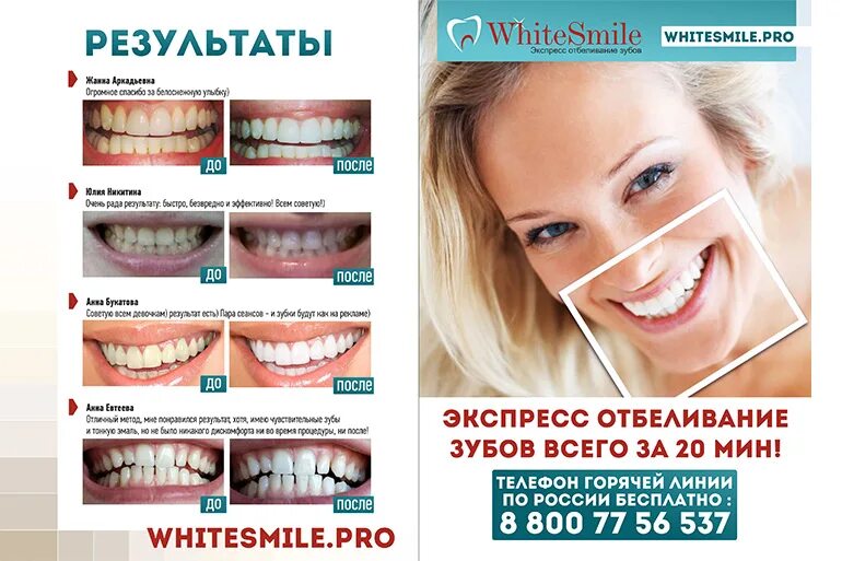 Отбеливание зубов. Отбеливание зубов White smile. Косметическое отбеливание зубов реклама. Стоматология после до реклама.