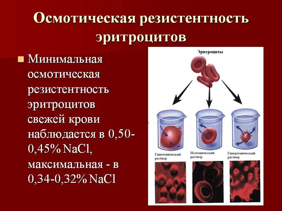 Гемолиз 3