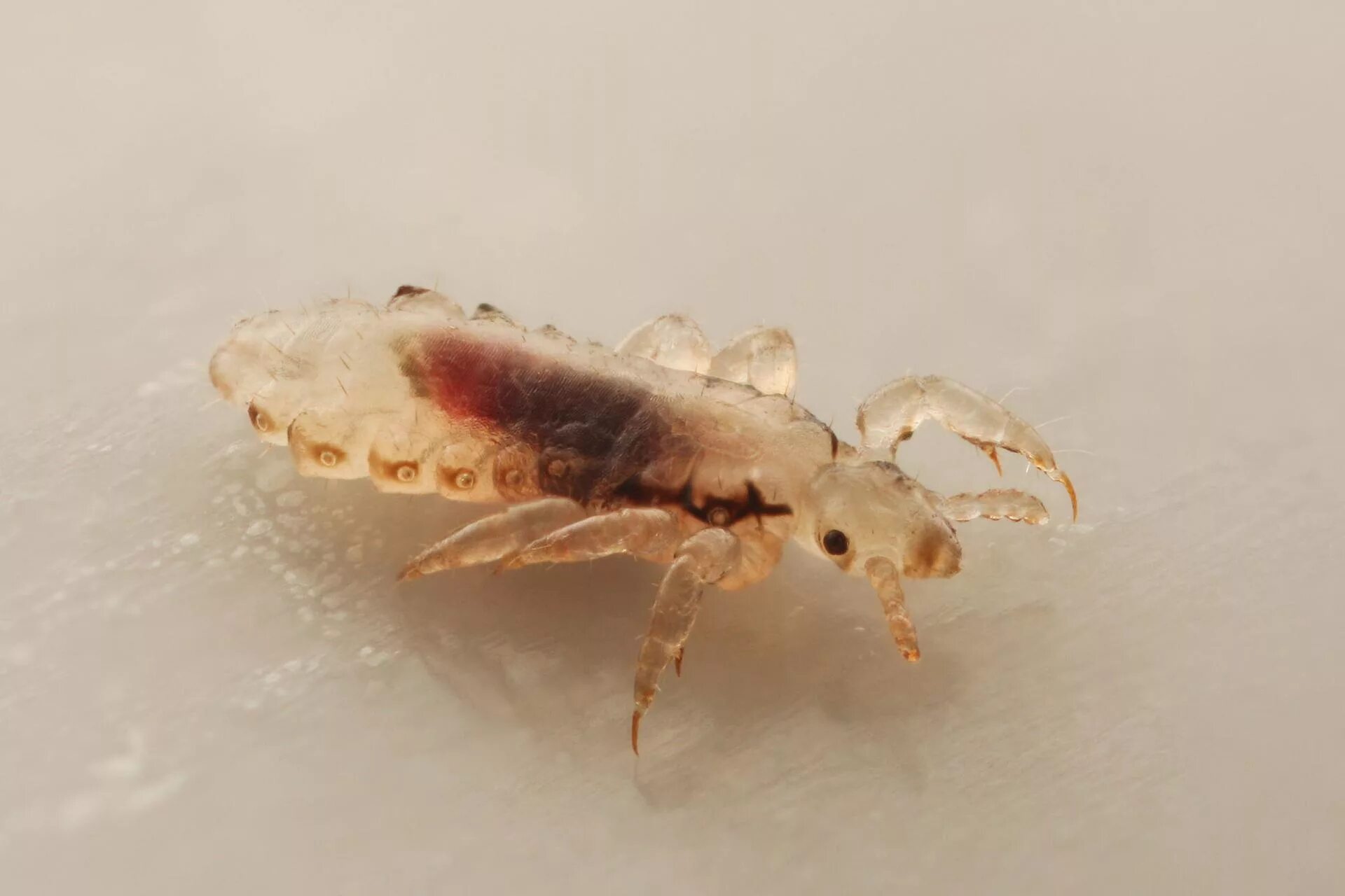 Головная вошь (Pediculus humanus capitis).