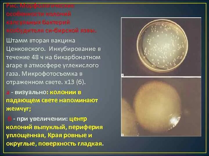 Сибирская язва симптомы у человека. Сибиреязвенная бацилла под микроскопом. Сибирская язва симптомы. Штамм сибирской язвы. Bacillus anthracis на кровяном агаре.