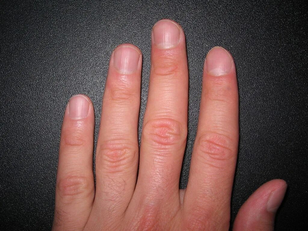 Нормальный цвет ногтей на руках.