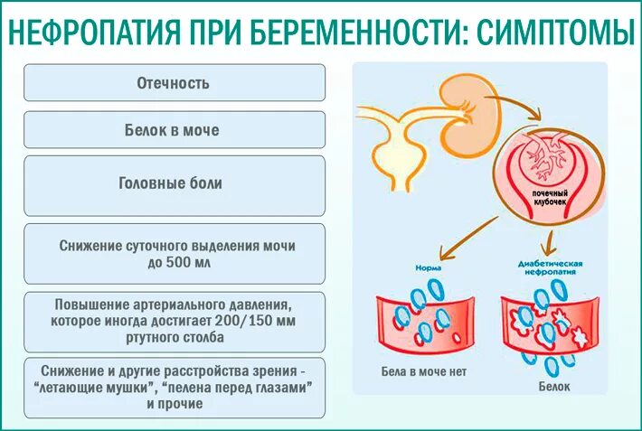 Болят почки при беременности. Заболевания почек у беременных. Единственная почка и беременность. Заболевания мочевыделительной системы у женщин. Симптомы почек беременности.