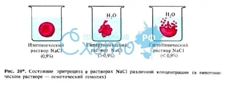 Эритроциты в растворе хлорида натрия. Гипертонический раствор эритроциты. Эритроциты в растворах разной концентрации. Эритроциты в гипотоническом растворе. Состояние эритроцита в изотоническом растворе.