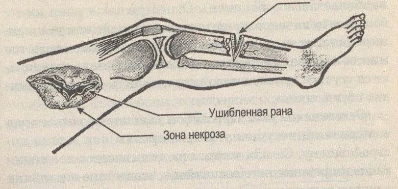 Рублено в области. Рубленная рана рисунок.