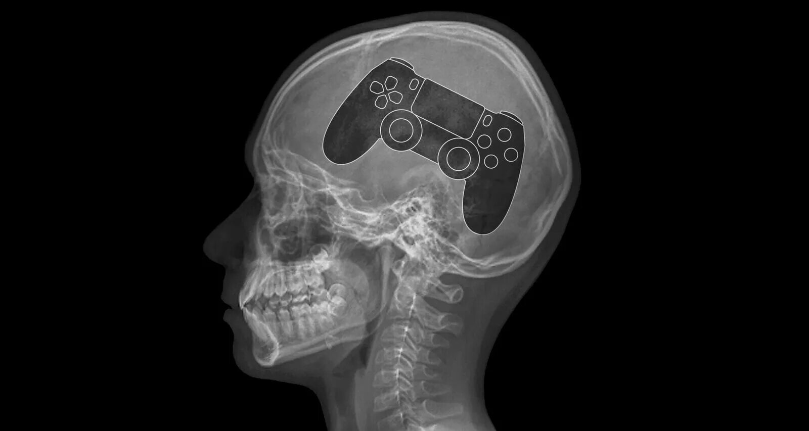 Игра без мозгов. Рентген головы человека. Рентгеновский снимок головы человека.