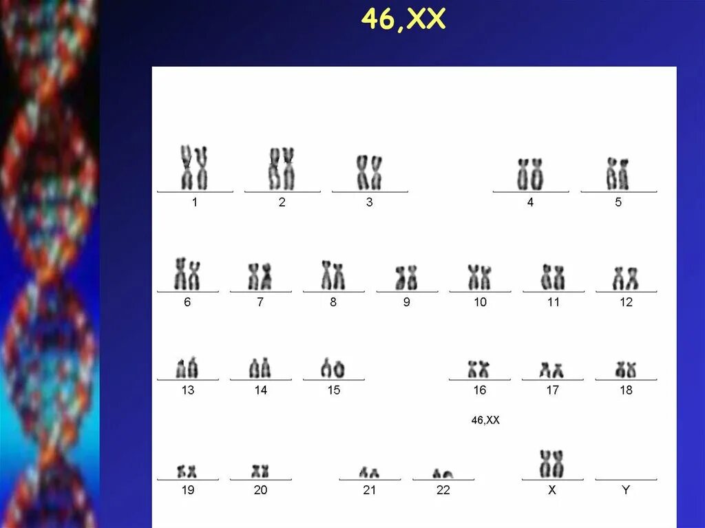 46 хх