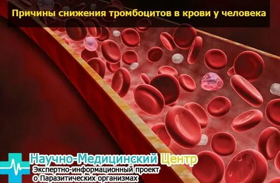 Как увеличить уровень тромбоцитов. Поднять тромбоциты в крови быстро. Аспирин и тромбоцитоз. Тромбоцитоз. Реактивный тромбоцитоз.