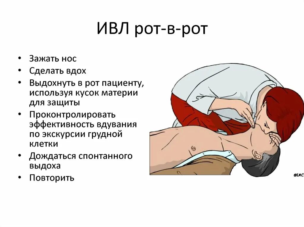 Эффективное искусственное дыхание. Опишите порядок проведения искусственной вентиляции легких.