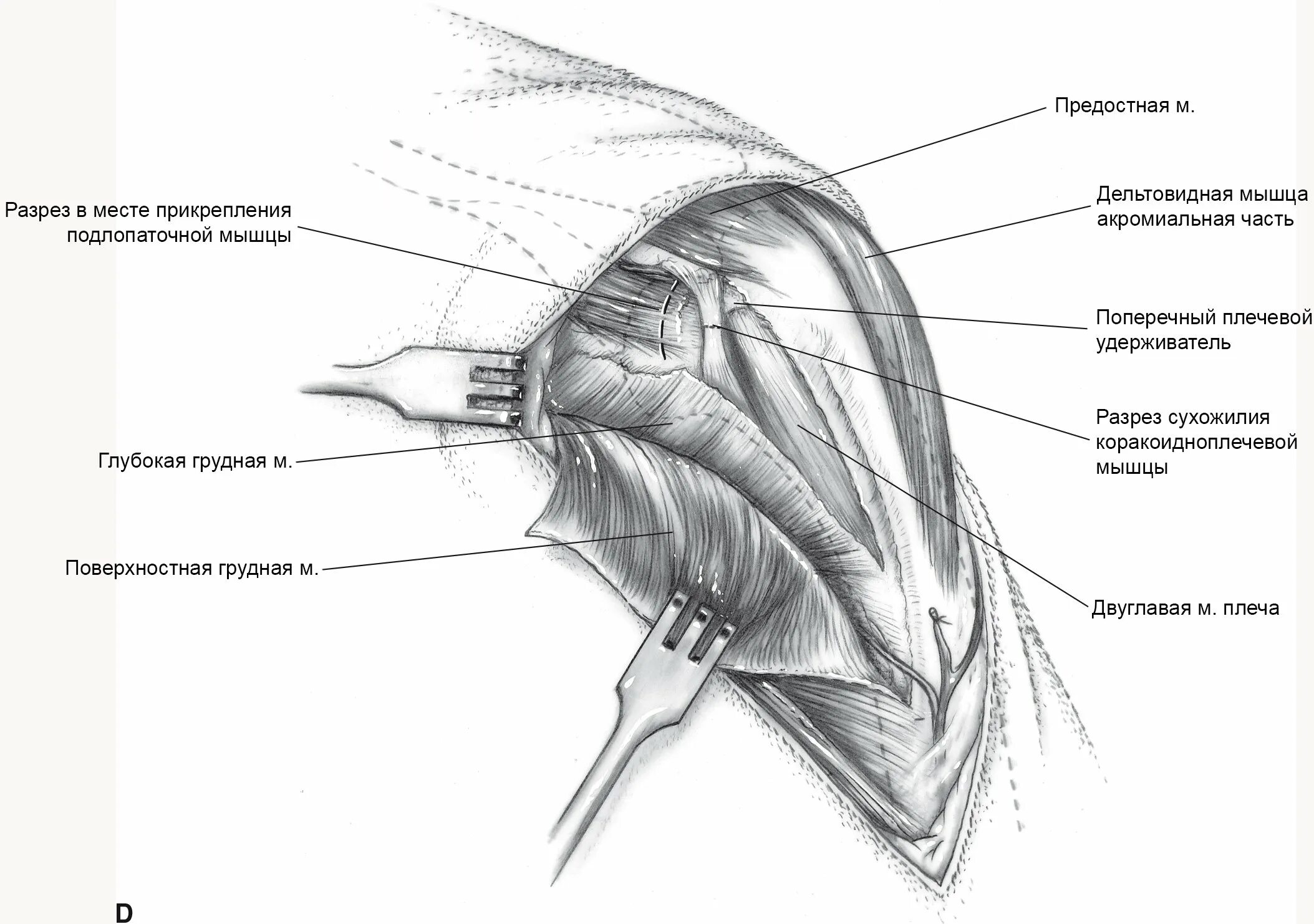 Передние пучки дельтовидных. Плечевой сустав дельтовидная мышца. Сухожилие дельтовидной мышцы плеча. Дельтовидная мышца плеча КРС. Завороты плечевого сустава топографическая анатомия.