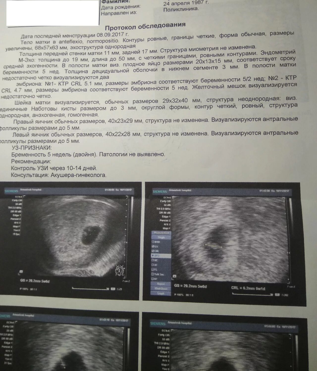 Разница акушерской недели и. УЗИ плодное яйцо 6 недель двойня. УЗИ 6 недель беременности Близнецы. Многоплодная беременность УЗИ 6 недель. УЗИ на 5 акушерской неделе многоплодной беременности.