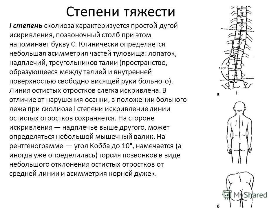 Сколиоз 1 степени рентген. Сколиоз 3 степени угол Кобба. Сколиоз 1 степени рентген описание. Сколиоз 1 степени по чаклину.