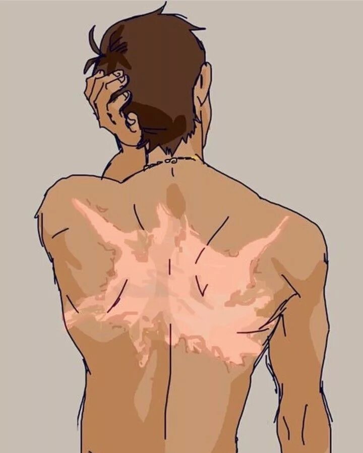 Шрамы референс. Шрам от ожога референс. Шрам от ожога реыерерс. Шрамы референс. Референс парень.