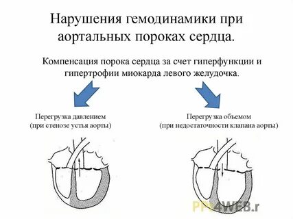 Гемодинамика нарушена