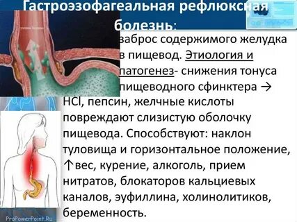 Желудочный сок попадает в горло