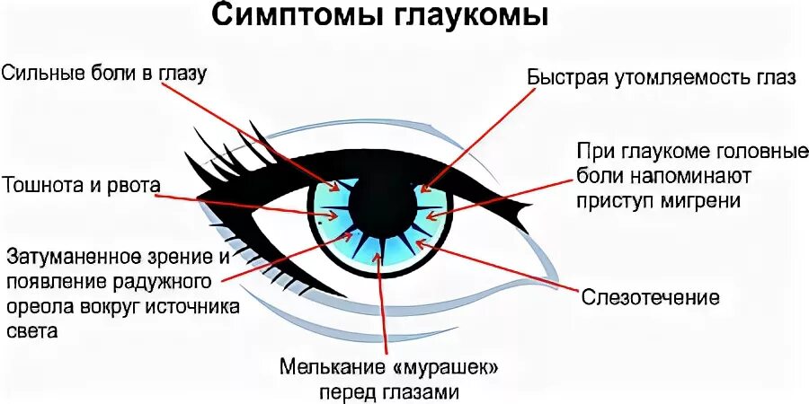 Можно вернуть зрение при глаукоме. Глаукома схема глаза. Признаки глаукомы глаукома симптомы. Основные признаки глаукомы.