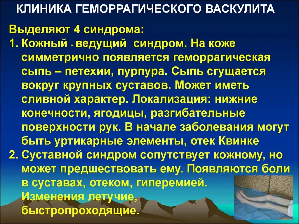 Синдромы при геморрагическом васкулите