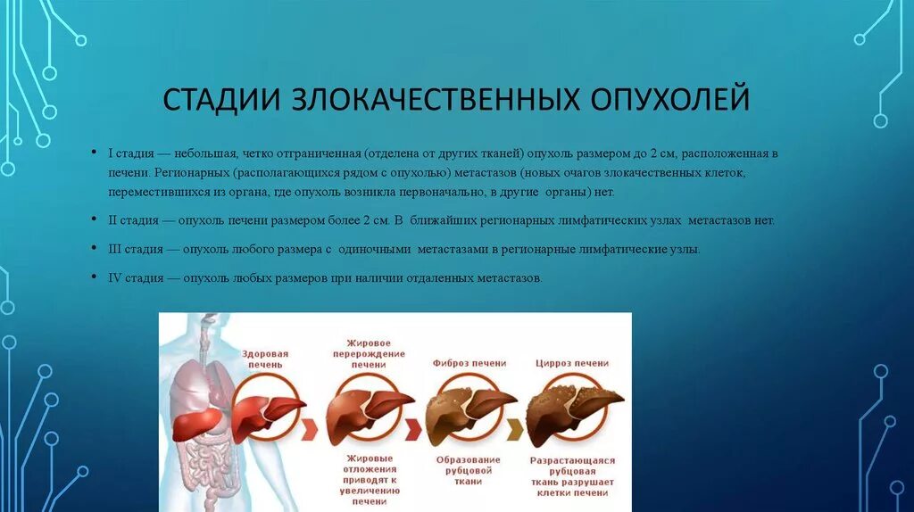 Стадии развития злокачественных опухолей. Фазы развития злокачественной опухоли. Этапы формирования злокачественных опухолей. Стадии формирования опухоли. Возникновения злокачественных новообразований