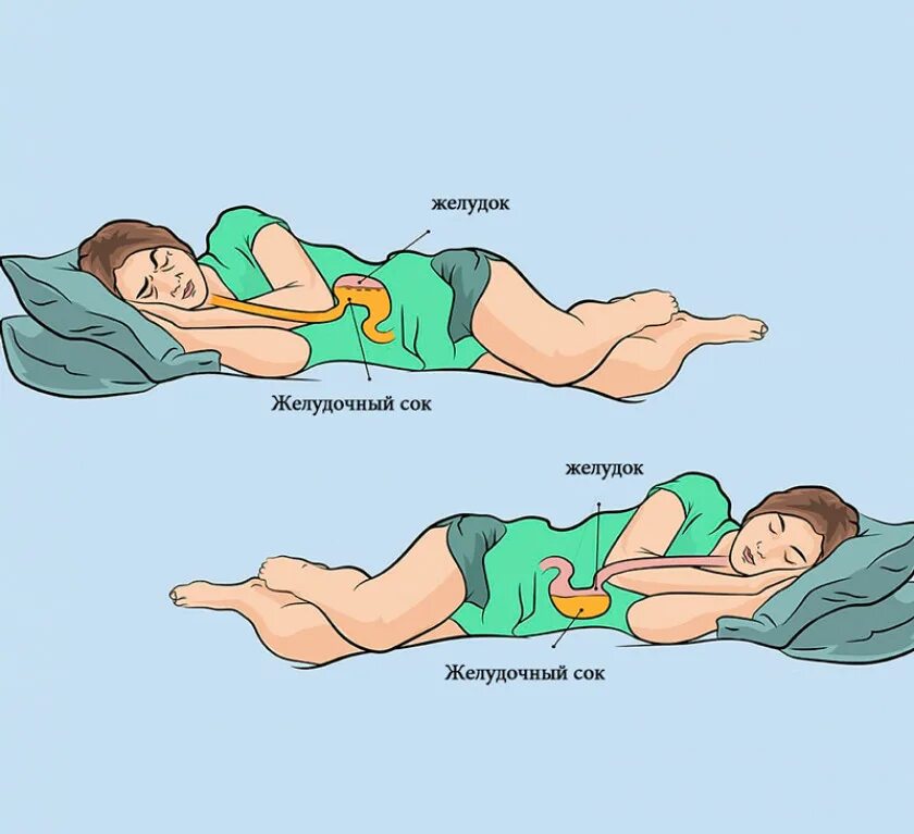 Правильная поза для сна. Правильное положение для сна. Правильная поза для сна на боку. Популярные позы для сна. Почему после операции нельзя спать