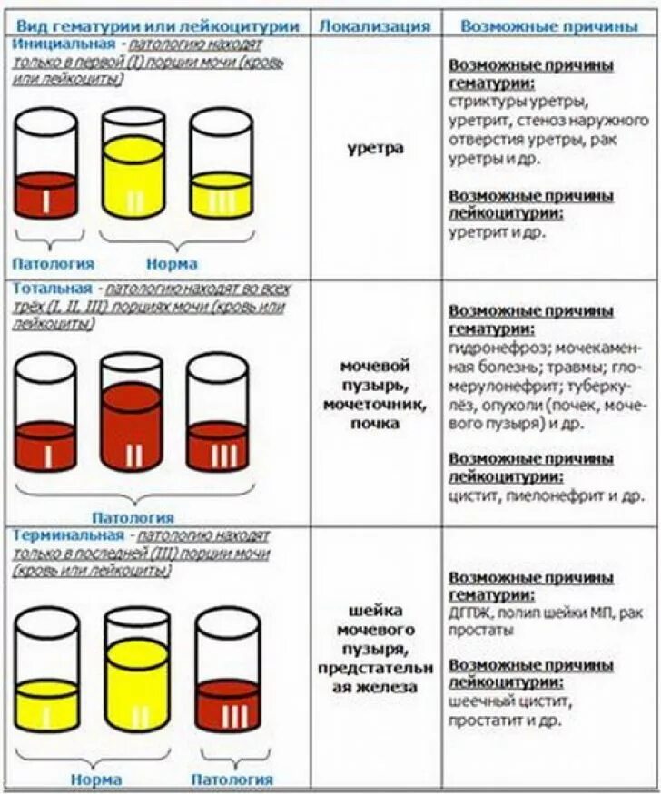 Трехстаканная проба мочи. Исследование мочи трехстаканная проба. Исследование мочи по Зимницкому норма. Анализ мочи 2 стаканная проба. Зимницкий анализ мочи.