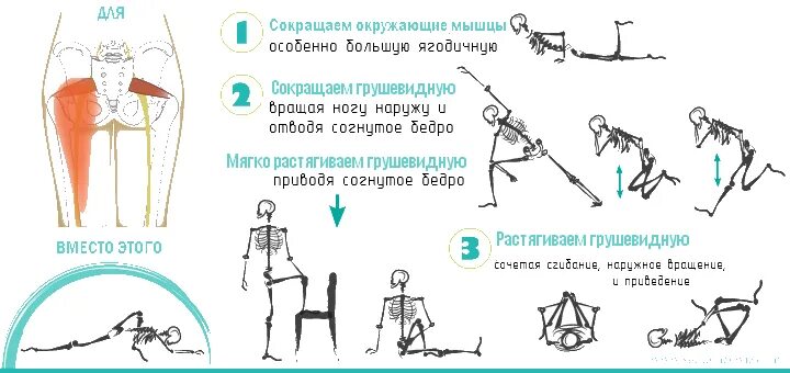 Лфк при синдроме грушевидной мышцы