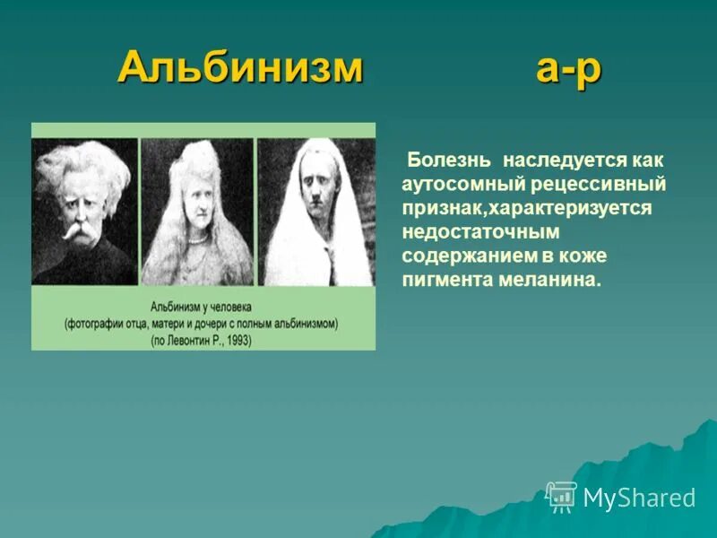 глазокожный альбинизм болезнь. как на ледуется альбинизм. альбинизм рецессивный признак. альпенизм аутосомный рецесивеый признак. отсутствие потовых желез у человека наследуется как.