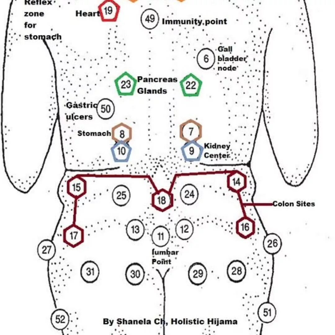 Банки на печень. Схема хиджама точки. Точки хиджамы схема для мужчин. Хиджама кровопускание схема точки. Атлас точек хиджамы схема.