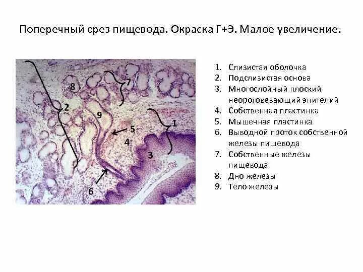 Клетки пищевода. Поперечный срез пищевода гистология препарат. Поперечный разрез пищевода гистология препарат. Срез верхней трети пищевода гистология. Пищевод гистологический препарат.