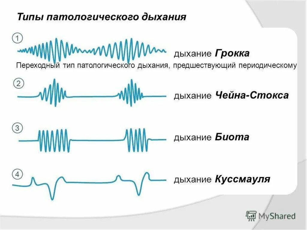 Дыхание Биота Чейна Стокса Куссмауля. Типы дыхания Куссмауля Чейна Стокса Биота. Типы дыхания Биота чейн Стокса патологические Куссмауля. Патологические типы дыхания чейн Стокса. Патологическое пространство