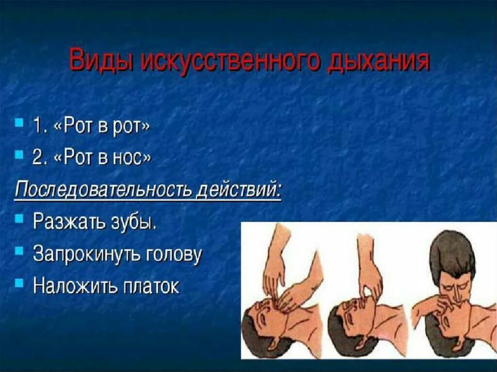 Основные виды неаппаратных способов искусственного дыхания. Виды искусственного дыхания. основные приемы искусственного дыхания. основные способы искусственного дыхания кратко. приемы проведения искусственного дыхания.