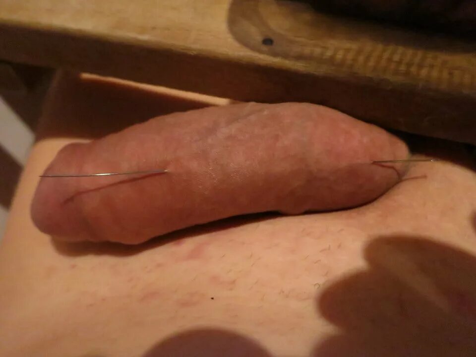 Куплю Отрезанный Член