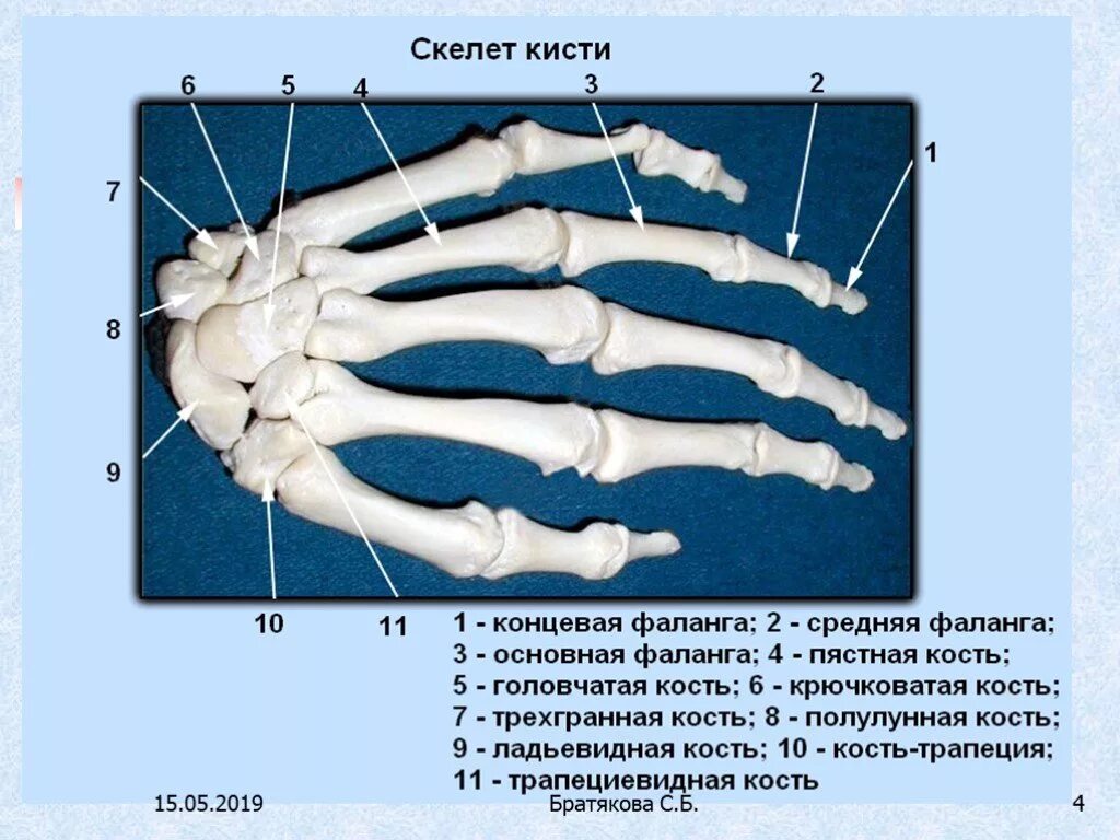 Кости в запястье руки. Скелет кисти руки человека. Кости кисти конечностей. Кости кисти анатомия человека. Кисть руки скелет строение.