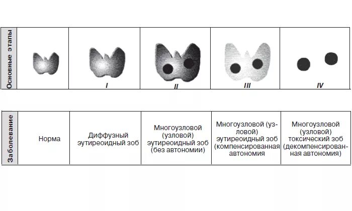 Диффузно-Узловой зоб 1 степени щитовидной железы. Диффузный Узловой зоб кт. Диффузно-Узловой зоб мрт.