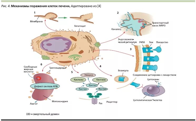 Иммуно опосредованный механизм повреждения гепатоцитов. Механизмы повреждения клеток печени. Цитолиз гепатоцитов.