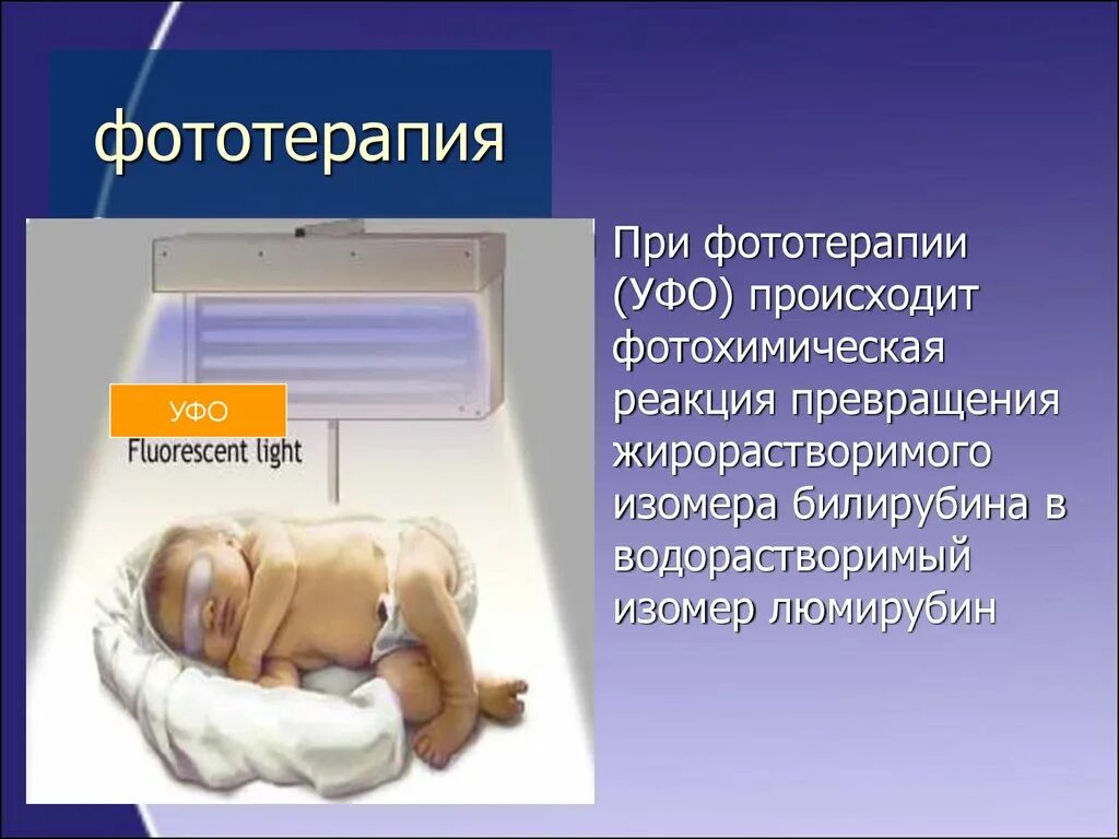 Фототерапия алгоритм. Фототерапия презентация. светолечение фототерапия презентация. фототерапия презентация физиотерапия. фототерапия классификация.
