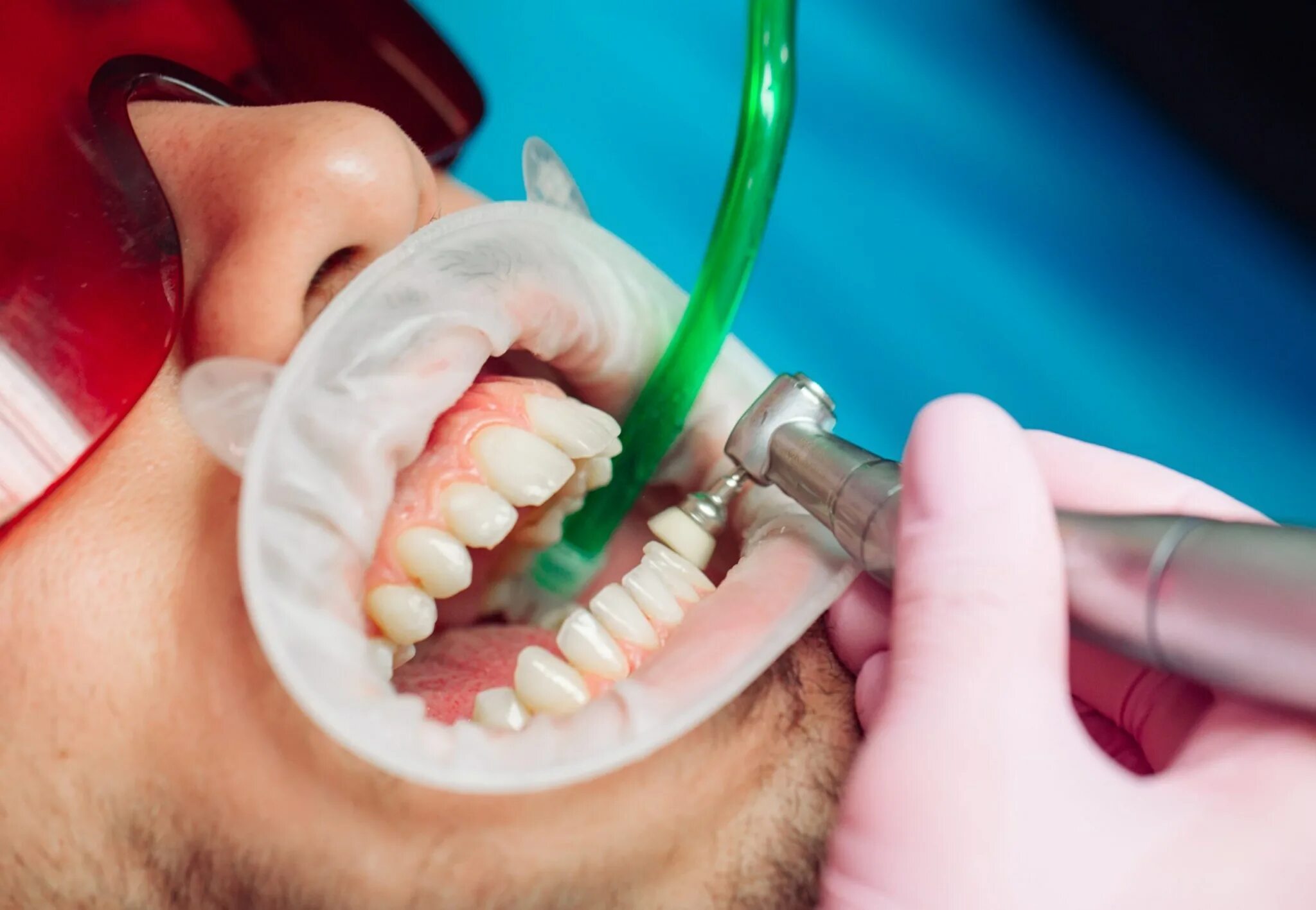 Чистка зубов вред