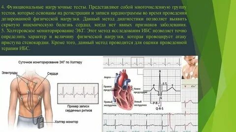 Электрокардиография при острых состояниях в сестринской практике