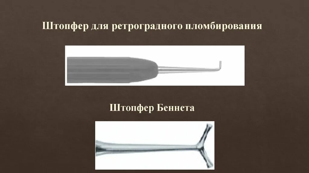 Ретроградное пломбирование корневых
