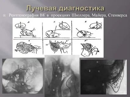 Рентген височных