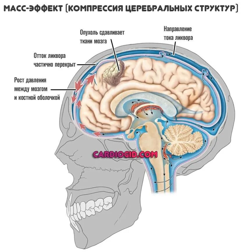 Церебральные структуры мозга. Ликвор в головном мозге. Циркуляция ликвора. Движение ликвора в головном мозге. Шум в голове в мозге